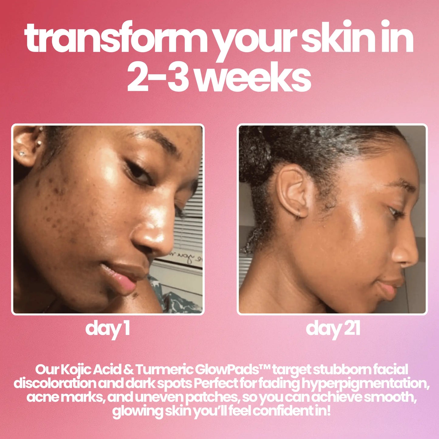 LUMELA™ glowpads