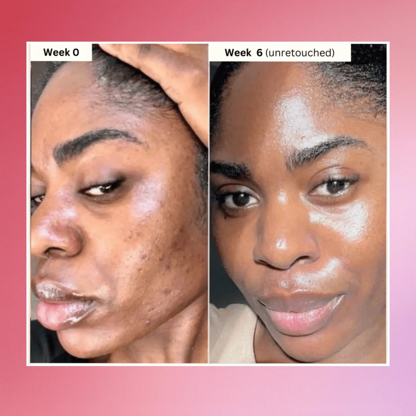 LUMELA™ glowpads