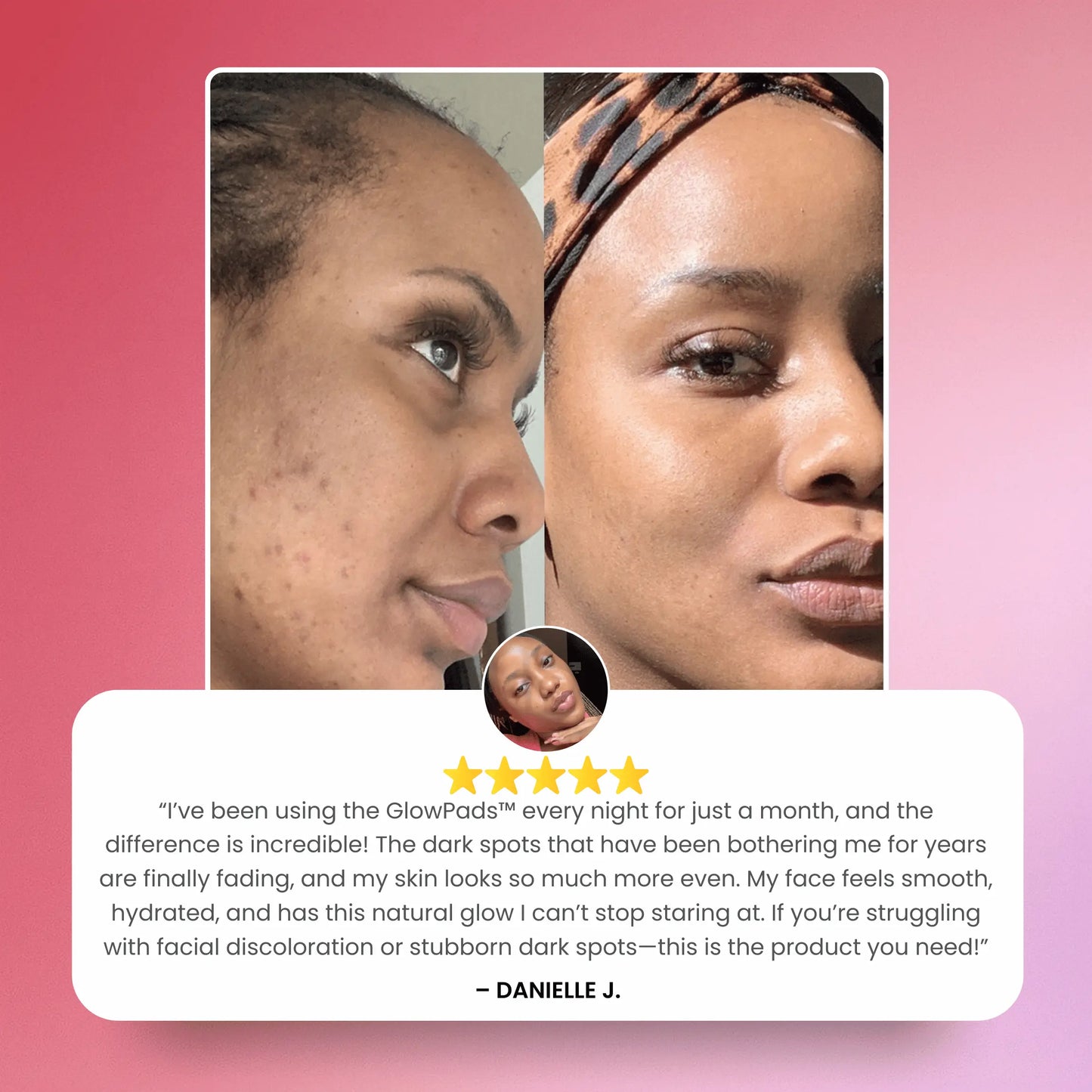 LUMELA™ glowpads