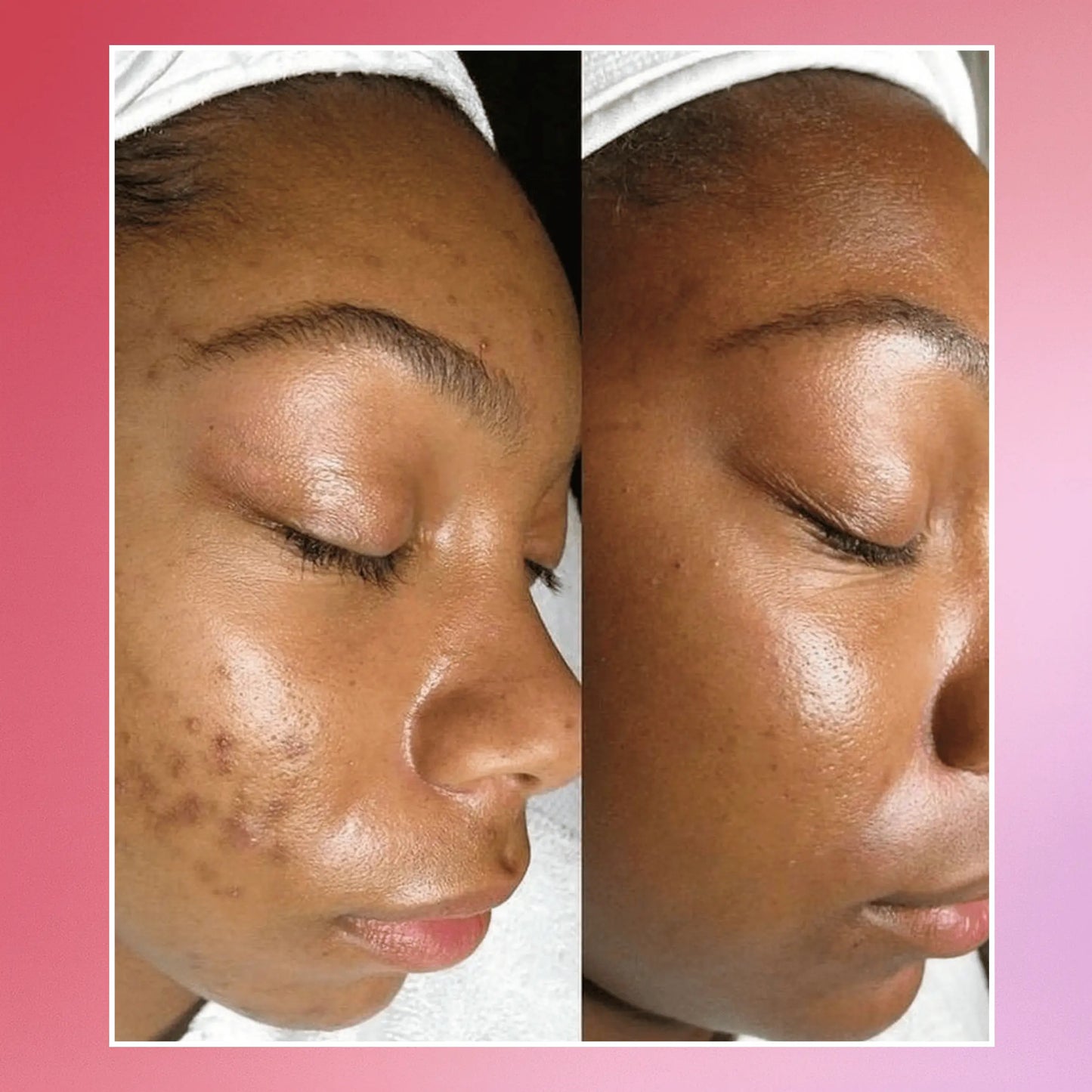 LUMELA™ glowpads